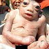 Bayi Menyerupai Seekor Katak