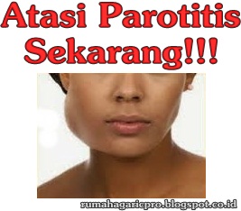 Obat Parotitis Obat Parotitis