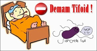 Cara Alternatif Mengobati Penyakit Demam Tifoid