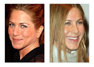 Jennifer Aniston Nose Jobs