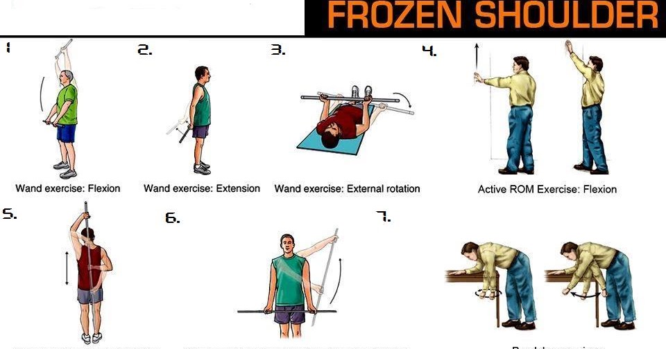 Physiotherapist advice on various diseases FROZEN SHOULDER