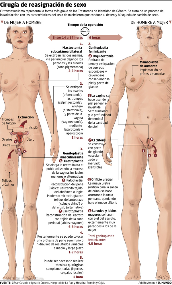 CAMBIO DE SEXO HOMBRE A MUJER cambio de sexo hombre a mujer: