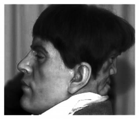 a man with two faces Was a nineteenth-century englishman named edward mordrake born with a malevolent 'second face' on the back of his head. a man with two faces Was a nineteenth-century englishman named edward mordrake born with a malevolent 'second face' on the back of his head.