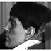 UNBELIEVABLE! Man Born with a two face.