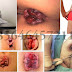 Seks Anal atau Lewat Dubur Rentan Kena Ambeien thumbnail