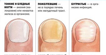 День Рождения в затеряном мире Пещера динозавра Гормональные прыщи на лице - лечение, причины, профилактика