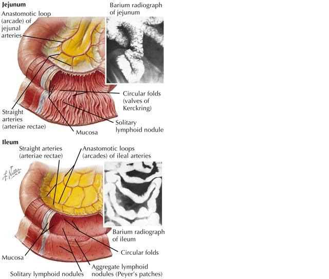 International University Small intestine disease