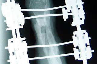 medicina bioregenerativa bioregeneracion