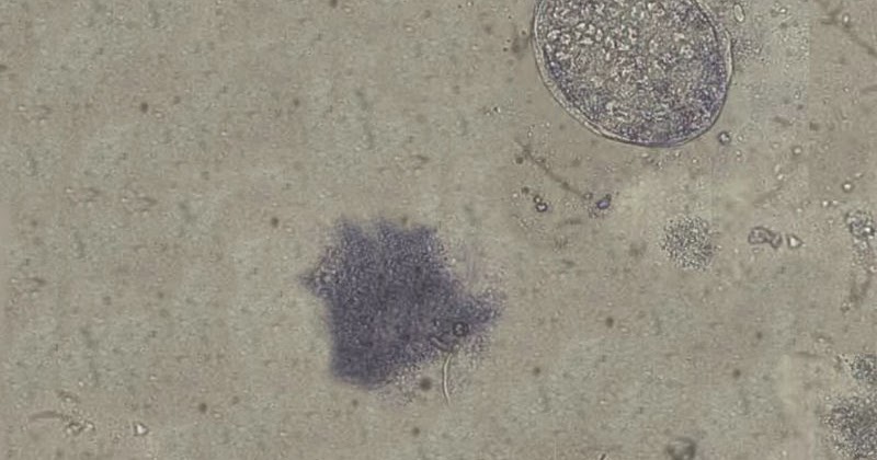 Medical Laboratory and Biomedical Science: Parasites in Stool