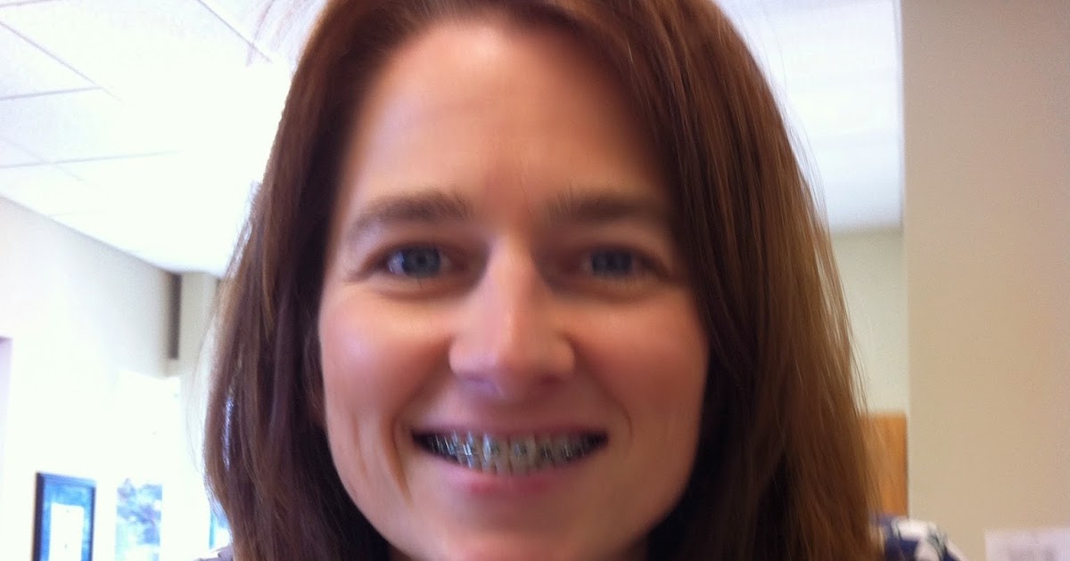 braces amy joy