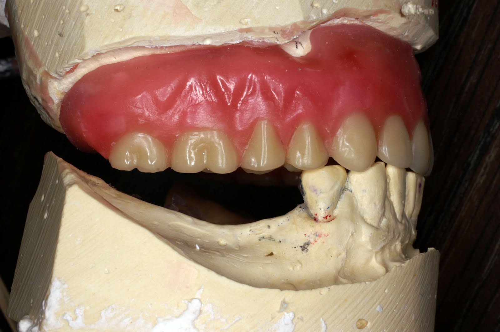 Premium partial and full dentures Straight from the Dentist's