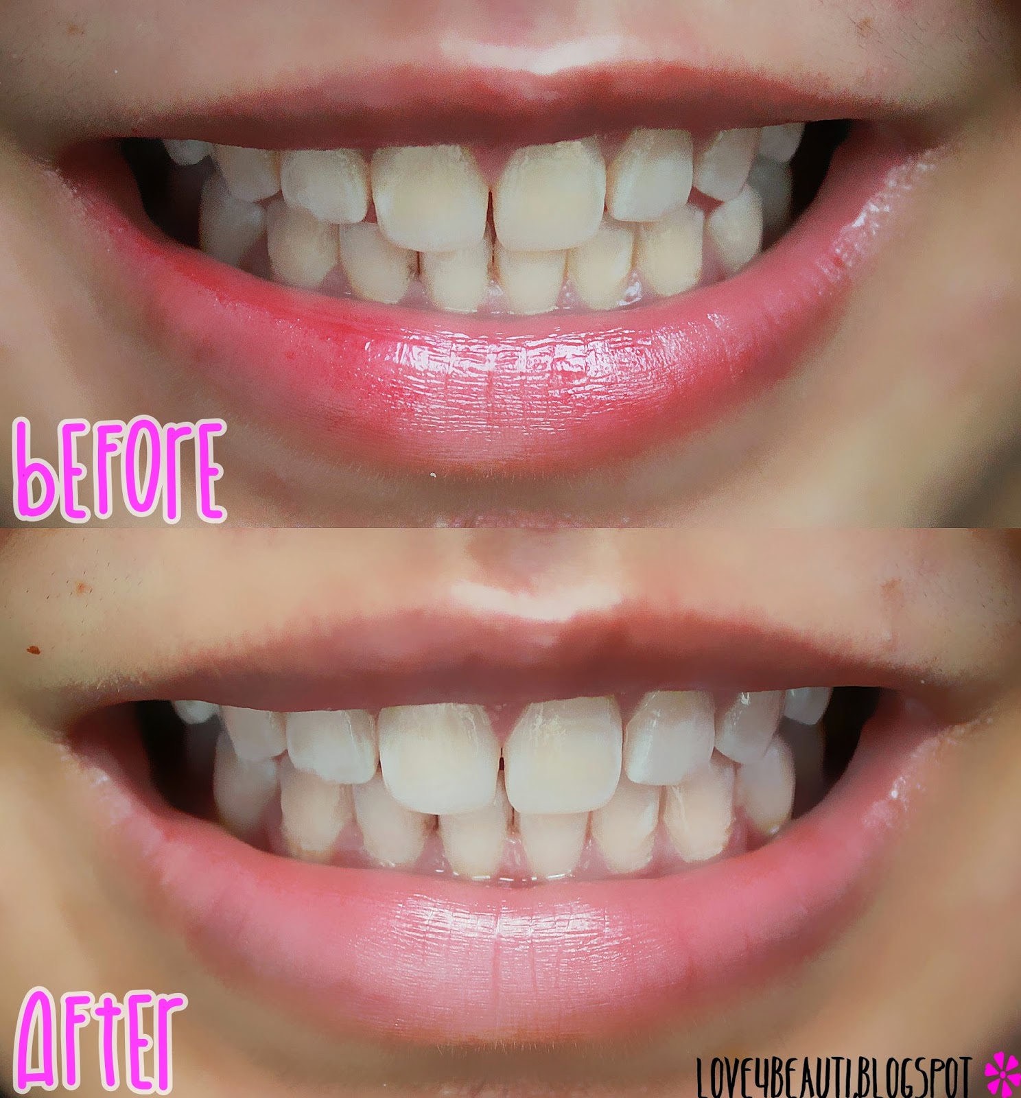 Izzahhahiraf Malaysian Beauty And Lifestyle Blog Review Dentiste Premium Natural White Toothpaste Tube