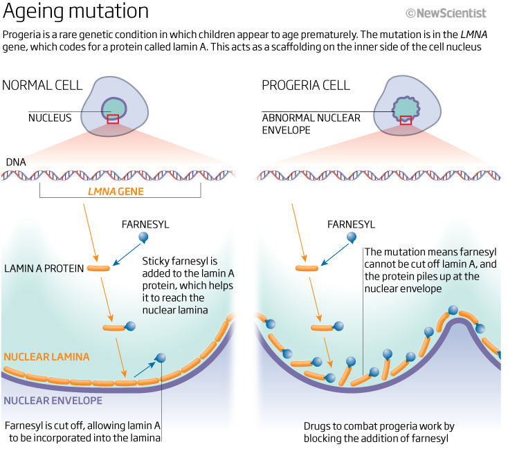 RESEARCH ON PROGERIA