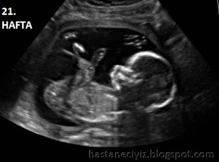 gebeliğin 21. haftasında bebek