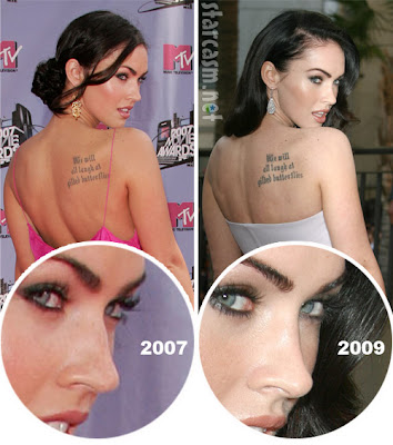 megan fox plastic surgery before and after