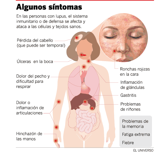 Los ejercicios a la lesión patrimonial sheynogo del departamento de la columna vertebral