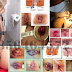 Cara Penyembuhan Wasir Tanpa Operasi Stapler thumbnail
