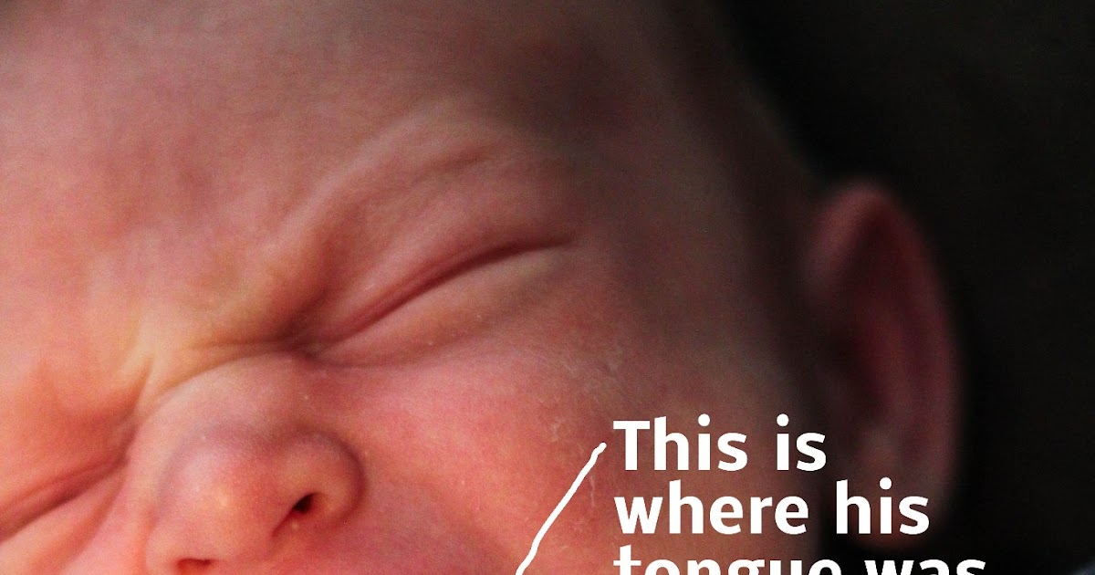 Hazardous Undertakings Tonguetied