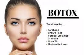 Botox Treatments