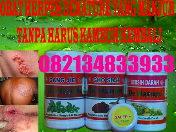 Obat Herpes Simplex 1