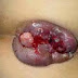 Obat Alami Anti Wasir Selain Ardium thumbnail