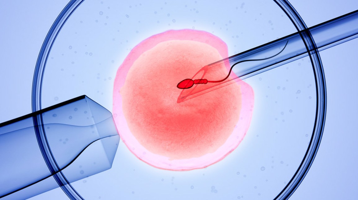Apa Itu IVF? Cara IVF Dilakukan Bagi Pasangan Yang Inginkan Anak