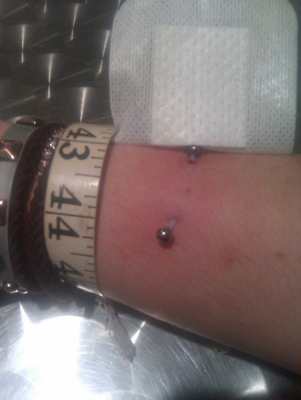 really loved it. When people spotted the bar in my arm, their faces title=
