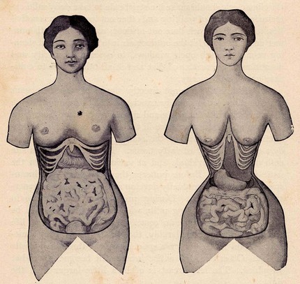 Can I Reduce My Waist Size By Wearing A Corset? Quora