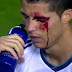 Video CR7 Di Sikut oleh Pemain Levante thumbnail