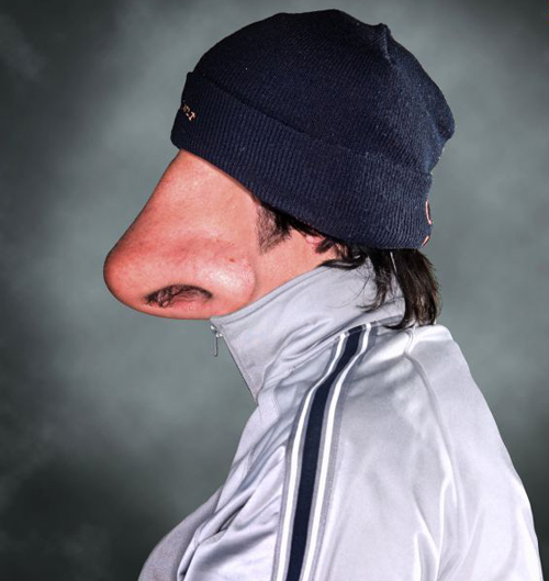 Manipulasi Hidung Manipulasi Hidung