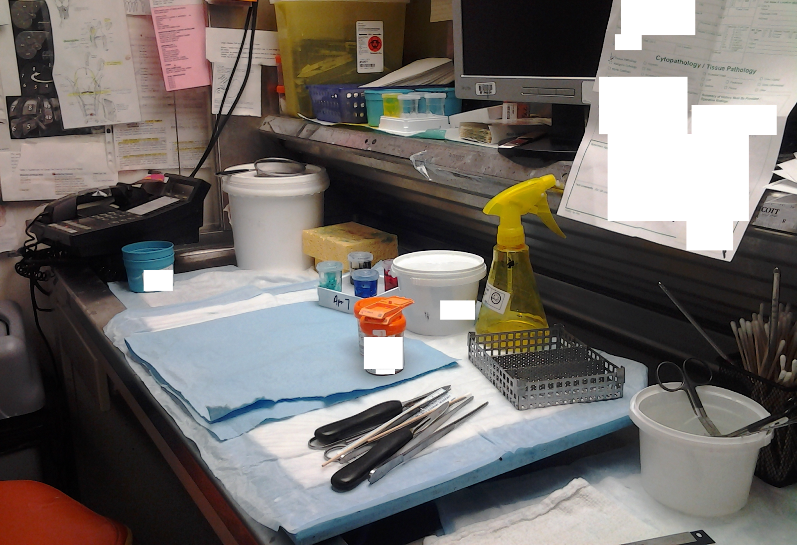 Winding Spiral Case A Day In The Life Pathology