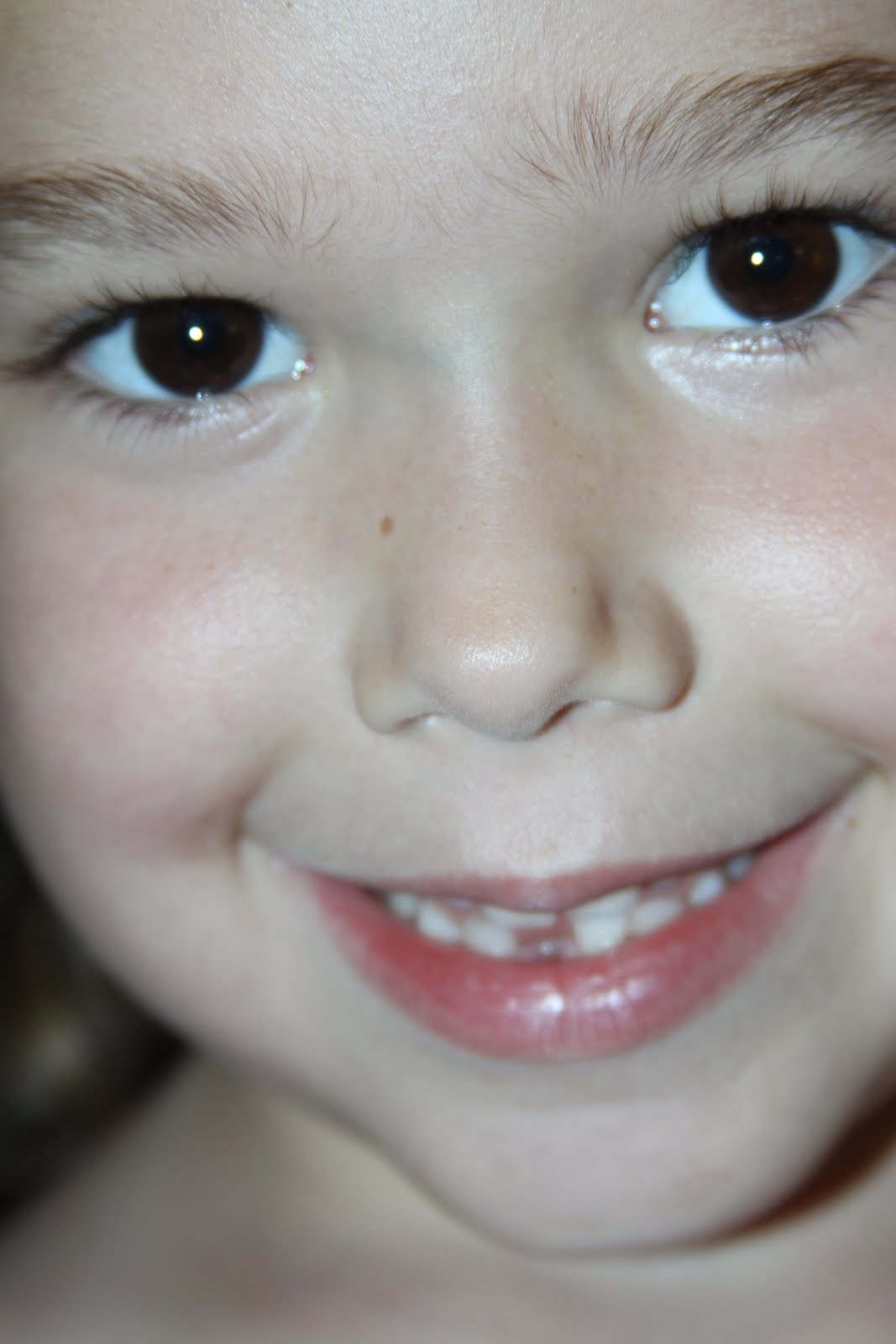 Tooth Watch
