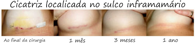 Meninas sem porta-seios com um pequeno peito