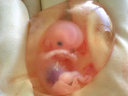 living miscarried feotus in amniotic sac