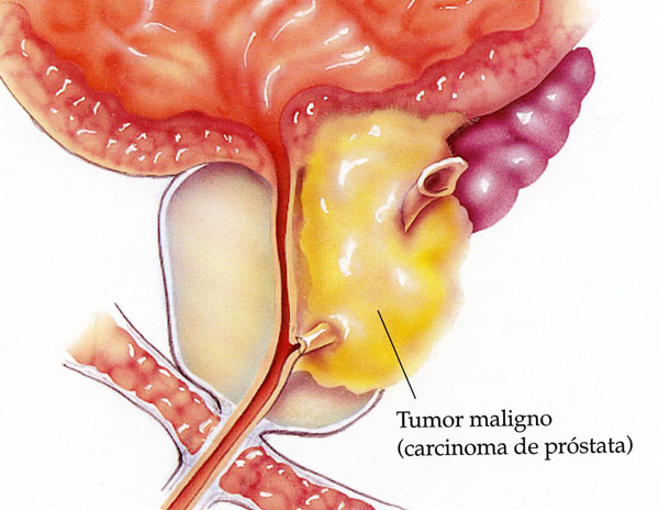 El tratamiento contra el alcoholismo por la acupuntura en sankt-peterburge