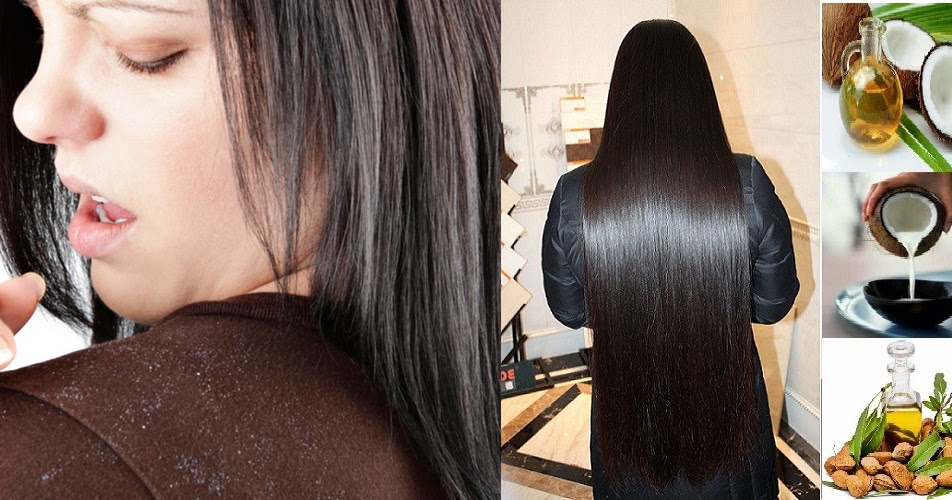 Lemon Juice Boosts Shine And Helps Oily Hair And Dandruff Life