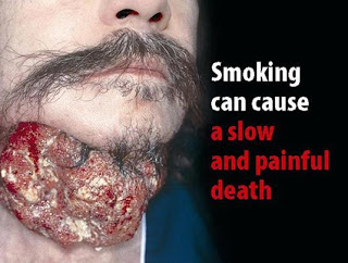 Bahaya Merokok Untuk Kesehatan Tubuh
