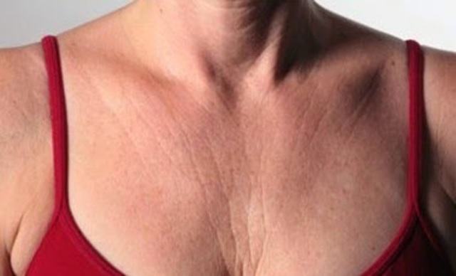 CUIDADOS PARA LA PIEL DEL CUELLO CUIDADOS PARA LA PIEL DEL CUELLO