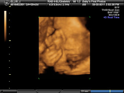 Our Boy At 28 Weeks