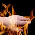 Obat Luka Bakar Alami Dan Aman thumbnail