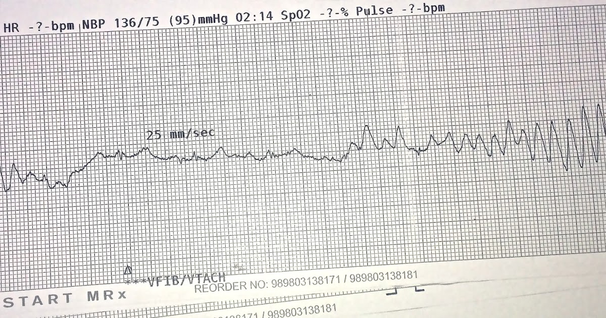 Kiwi Adventure Judder Bar Flutter