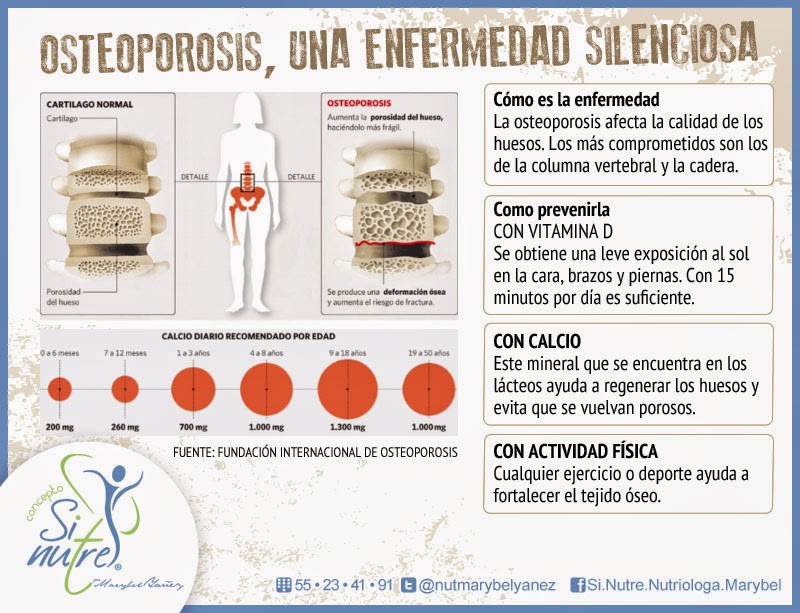 Infografía de la osteoporosis