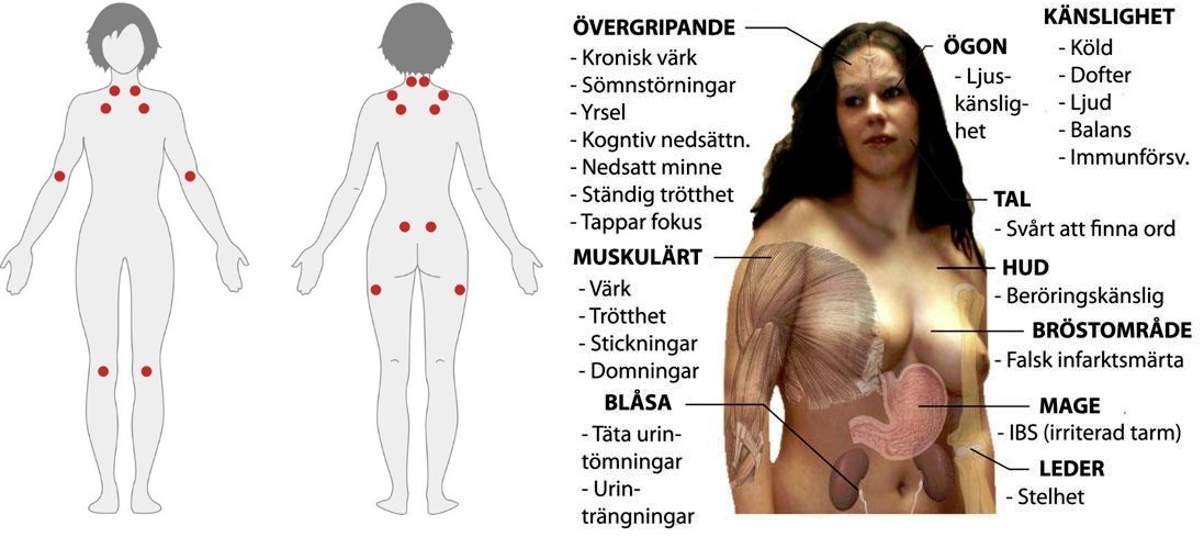 varför får man fibromyalgi