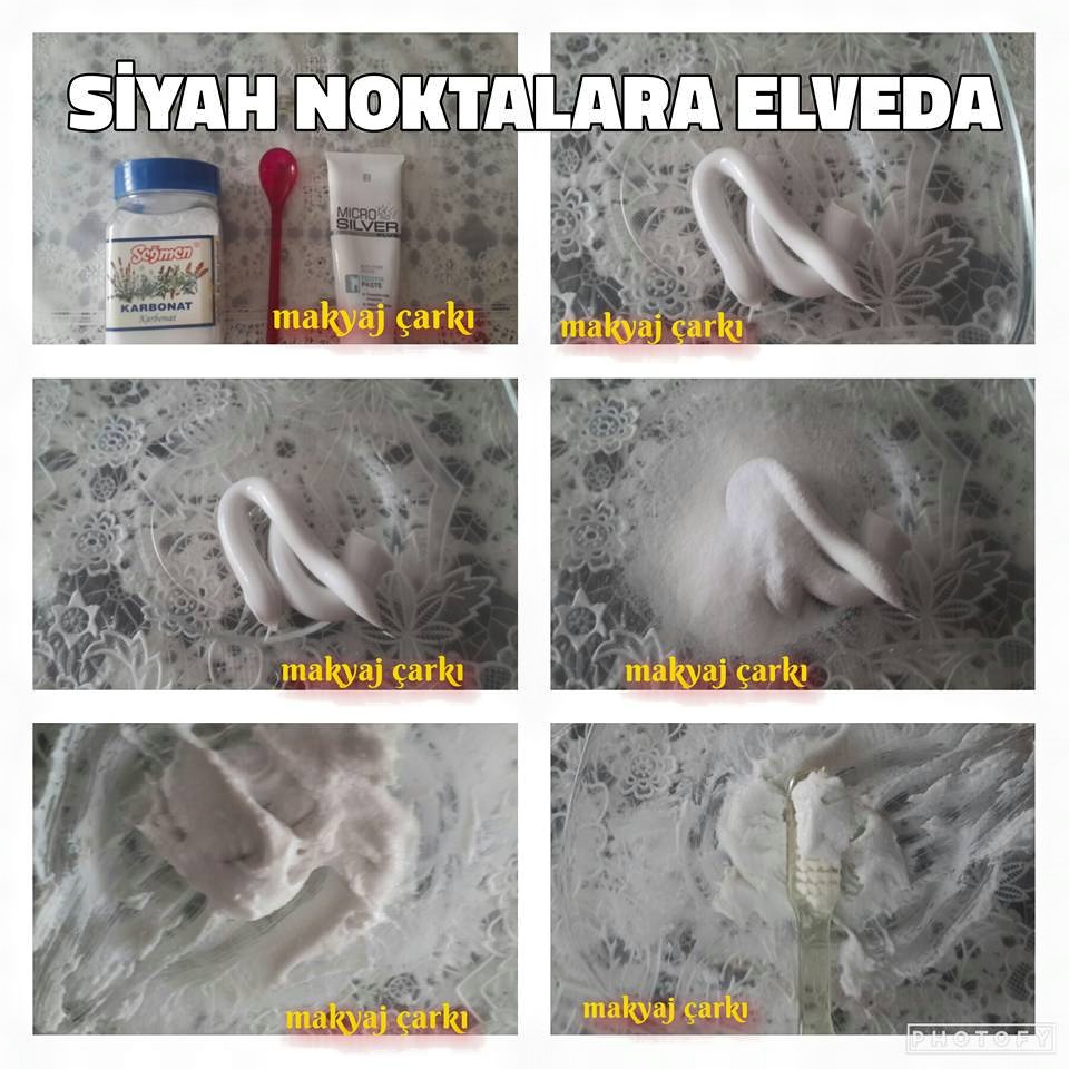 Siyah noktalara karbonatlı çözüm Siyah noktalara karbonatlı çözüm
