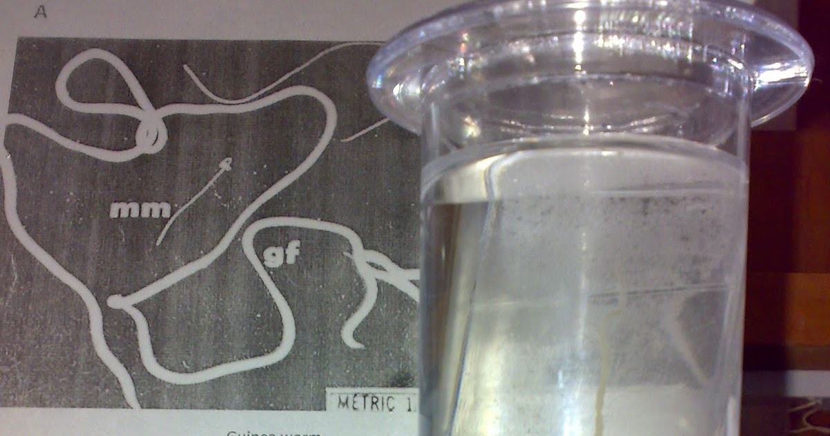 DRACUNCULUS MEDINENSIS Medicos Circle Academy