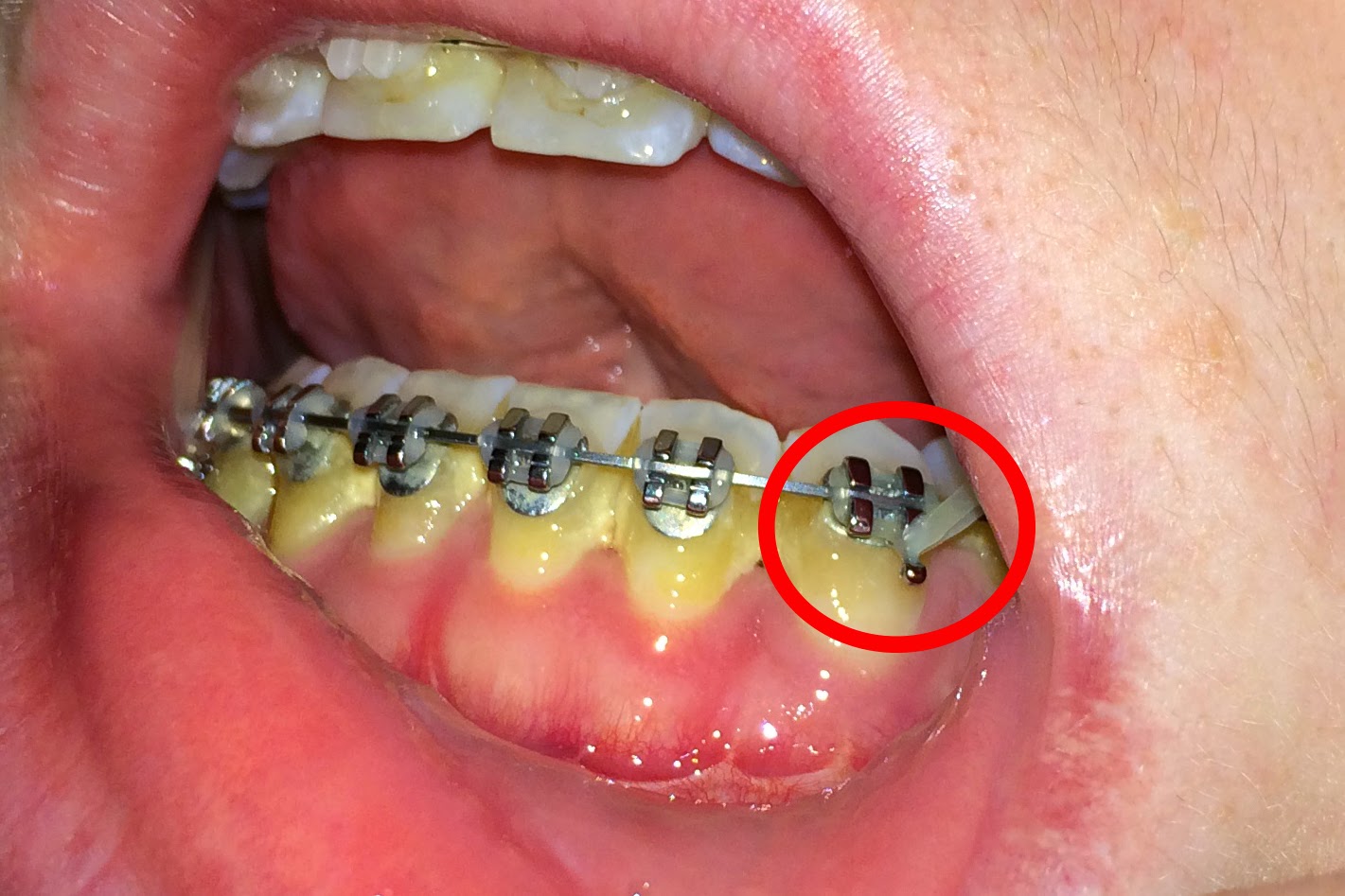 Stitch My Smile September 2014