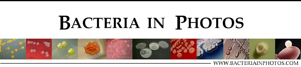 Bacteria in Photos