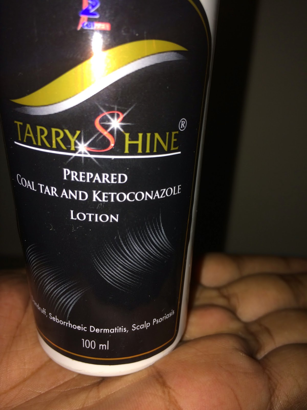 Dandruff And Hair Loss Problem In Banglore Solved