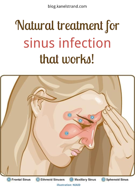 The Best Natural Treatment for Sinus Infection via @kanelstrand