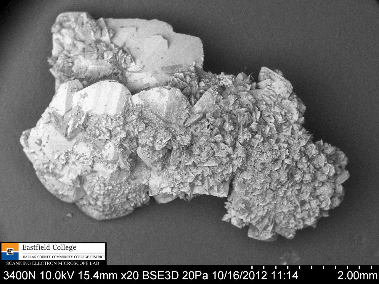 Scanning Electron Microscope Blog A Kidney Stone OUCH!!